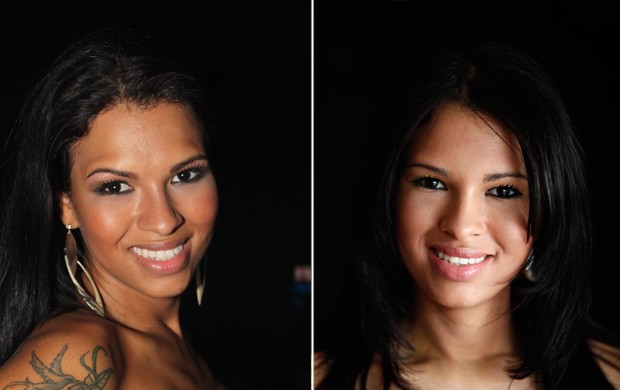  Ariadna, antes e depois da cirurgia plstica.